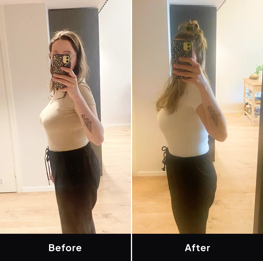 Agatha before and after image