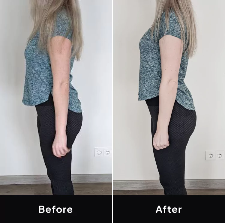 Roberta before and after image